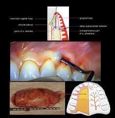 Critical considerations and clinical techniques for soft tissue management